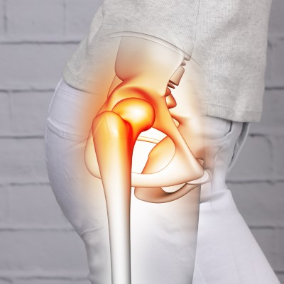 Prothèse de Hanche par voie antérieure, mini-invasive