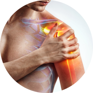 prothèse d'épaule ou pathologies des tendons du coude, Tennis Elbow